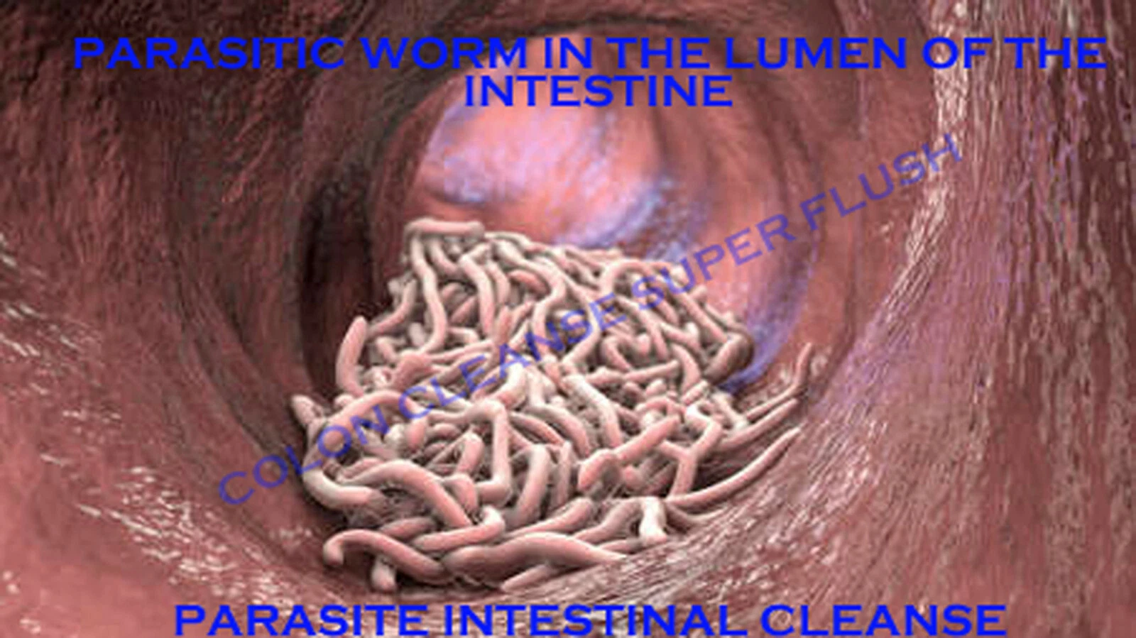 Parasite Intestinal Cleanse(Colon Cleanse Super Flush)Detox Candida Organic Herb