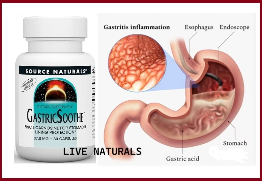 #1 Mastillas para ayudar con la gastritis y el reflujo acides estomacal